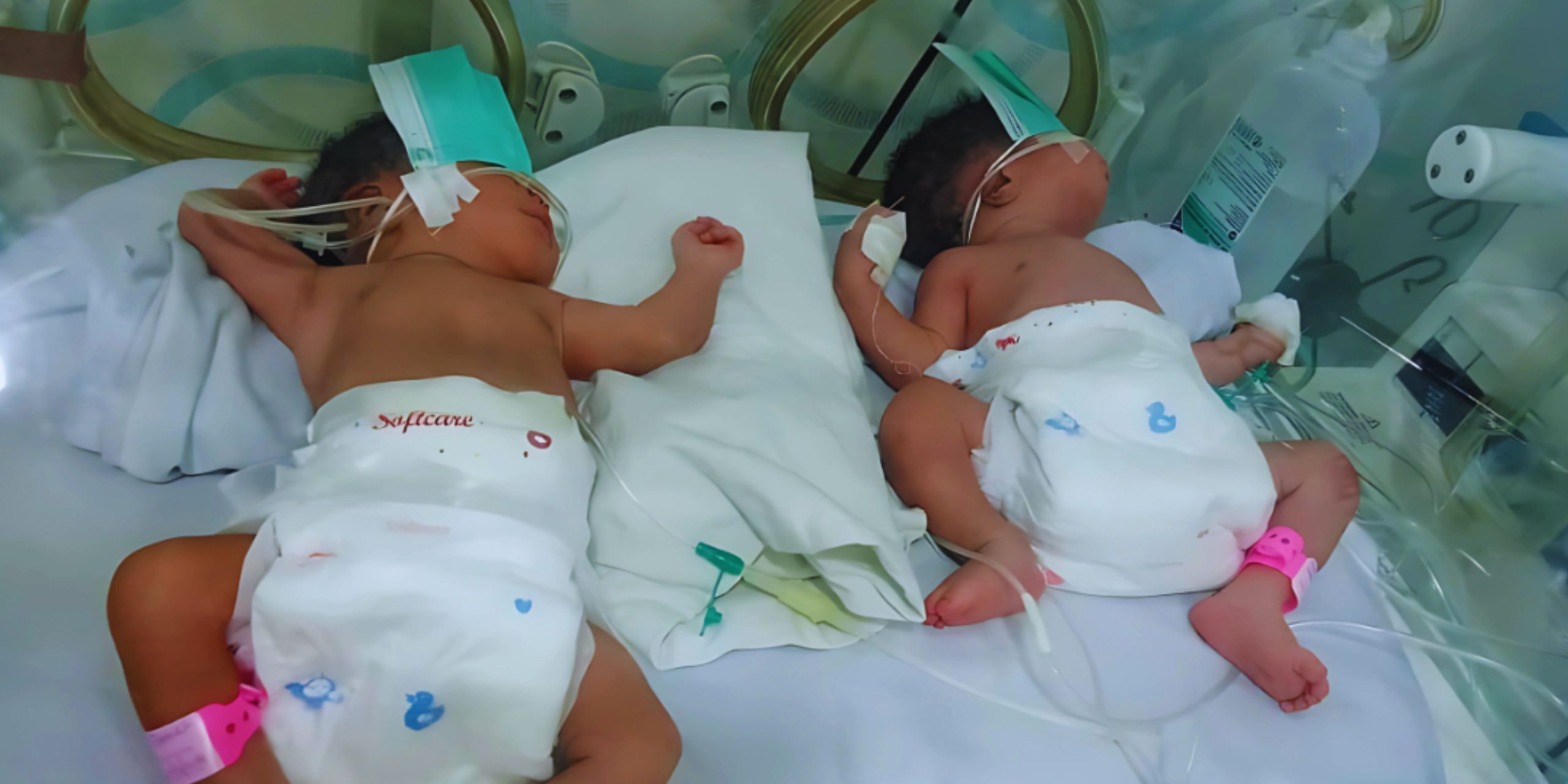 Read more about the article Premature Twins Fighting for Their Lives Teach Us Survival Even at the Darkest Times